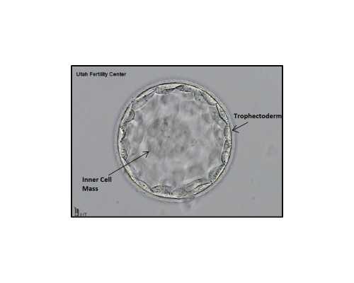 上海啥叫三代供卵,2026年上海私立机构**婴儿收费标准，**生男女3万元起步