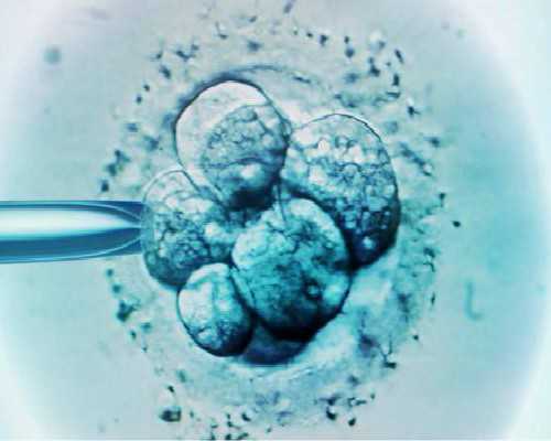 胚胎移植后睡觉姿势有讲究吗可以上班吗,做三代试管