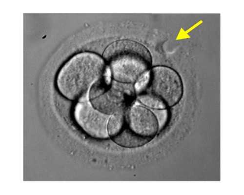 上海供卵好怀孕吗,上海试管性别是在取卵培育的时候吗_正规试管机构