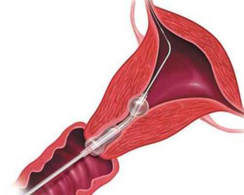 怎样备孕_育儿嫂中介公司,一直备孕但是排卵期同房也没怀上宝宝是怎么回事
