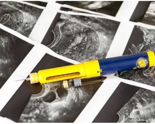 孕期胎心率看胎儿性别(b超从哪里可以看出性别)