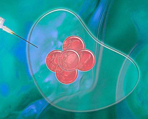 捐卵志愿者[内蒙古试管选aa69助孕],四平三代试管婴儿-2026四平3代试管医院及成