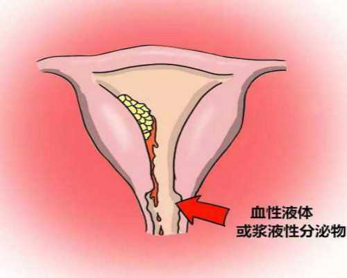 上海代孕公司排行榜,上海有供卵试管婴儿，咨询一下：上海供卵试管费用需要