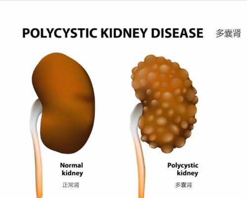 做试管为什么要查性激素6项？不正常的注意了！