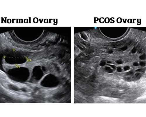 上海卵子库,供卵代孕婴儿预产期怎么计算？移植后保胎方法_上海供卵供卵代孕