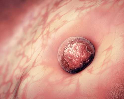 育儿心得怎么写?_育儿师资格证怎么考,备孕路上的拦路虎多囊卵巢该这么治？