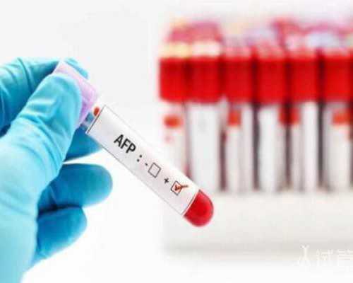 上海代生男宝宝,上海中医妇科张伟华博士，用中医辩症方法，帮助备孕3年患者