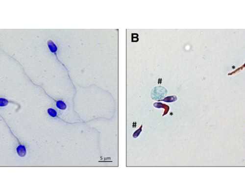 上海供卵代生技术,上海不孕不育医院：上海徐汇区擅长不孕不育的医院是哪家