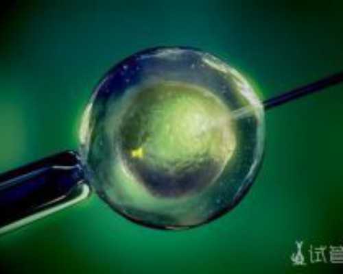 二代试管不是必须做无创，遇到这三种情况才真有必要